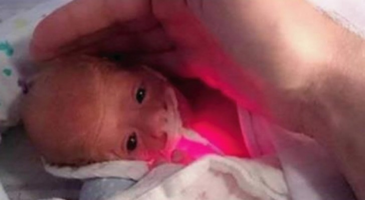 Il est né à 5 mois et pesait 600 grammes : aujourd'hui, il est devenu un bel enfant aux yeux bleus