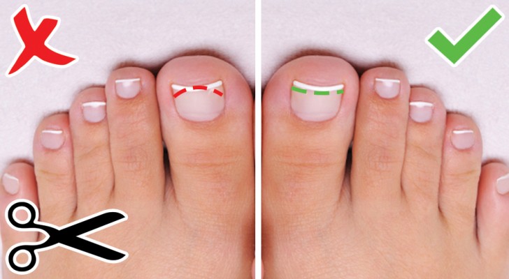 6 suggerimenti preziosi per rendere i vostri piedi e unghie bellissimi