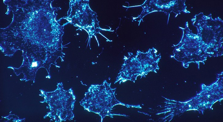 Onderzoekers ontdekken het eiwit dat tumoren laat groeien. Dit blokkeren zal betekenen dat kanker is te behandelen