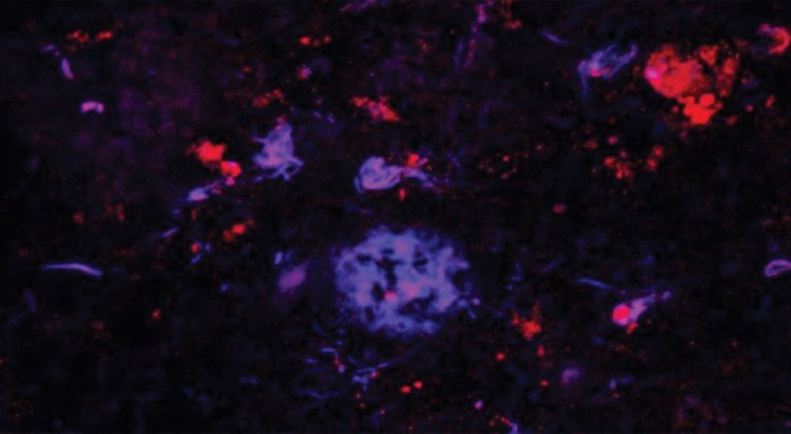 Gli scienziati sono riusciti ad eliminare l'Alzheimer nei topi