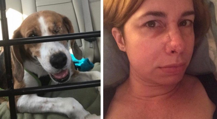 Her dog kept sniffing her nose and when her doctor tells her the reason, she understands that she owes her dog her life!