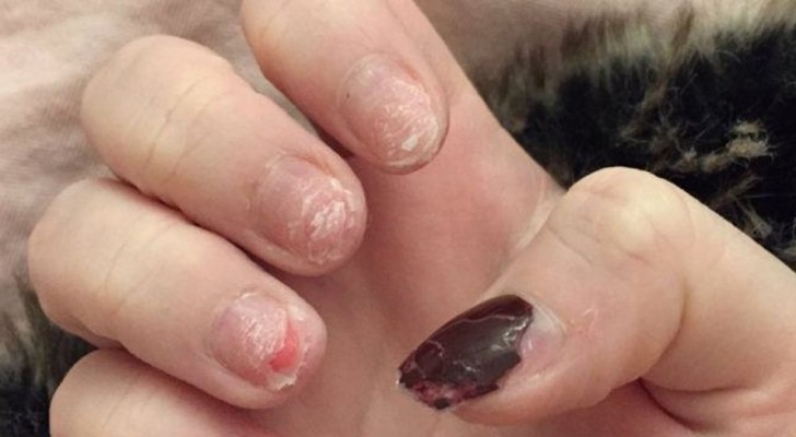 Nail care alert! Photos of this girl warn us about the risks of do-it-yourself nail art