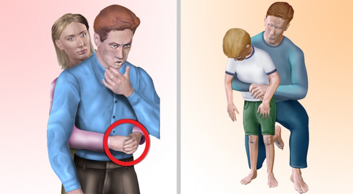 Suffocation : voici comment intervenir selon qu'il s'agit d'un adulte, d'un enfant ou d'un animal