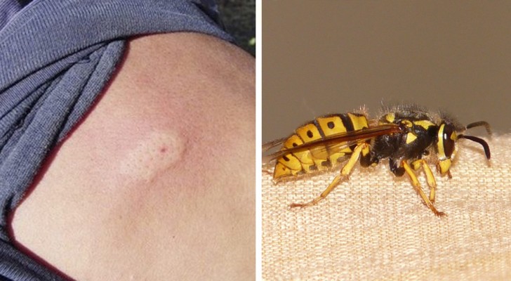 What to AVOID doing when you get stung by a bee or a wasp