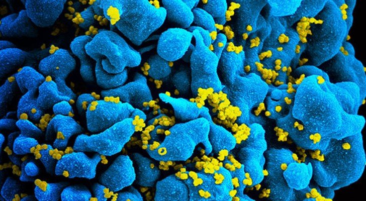 Gli scienziati hanno fatto un importante passo in avanti nella creazione di un vaccino contro l'HIV