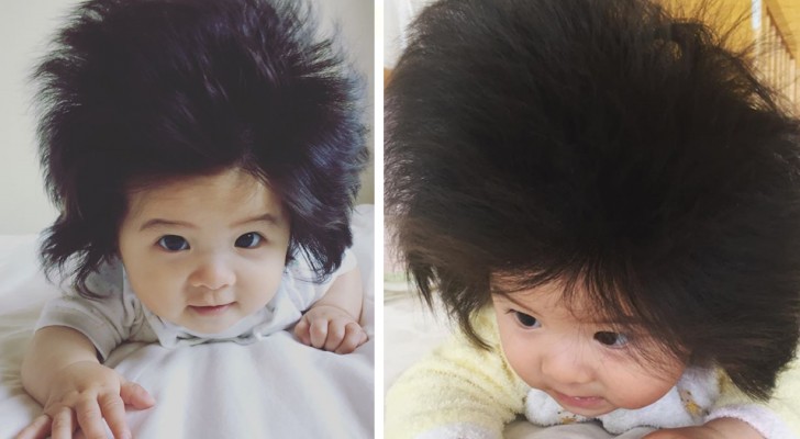 Dieses kleine Mädchen ist erst 7 Monate alt, hat aber bereits Berühmtheit erlangt mit ihren aussergewöhnlichen Haaren