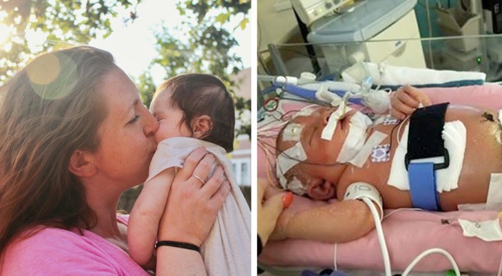 Non lasciare che tutti bacino il tuo bambino: ecco cosa è successo a questa neonata a causa di un bacio