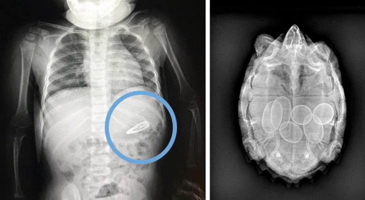 19 aparte röntgenfoto's waar radiologen van stonden te kijken