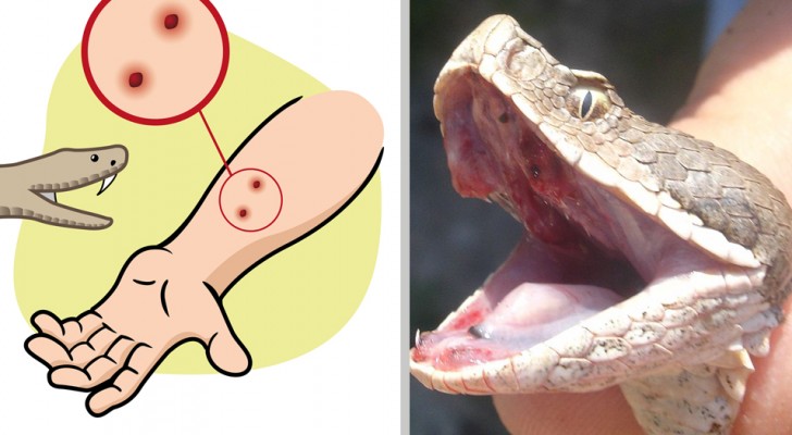 Viper snake bite: what to do and what not to do if you have no medical knowledge