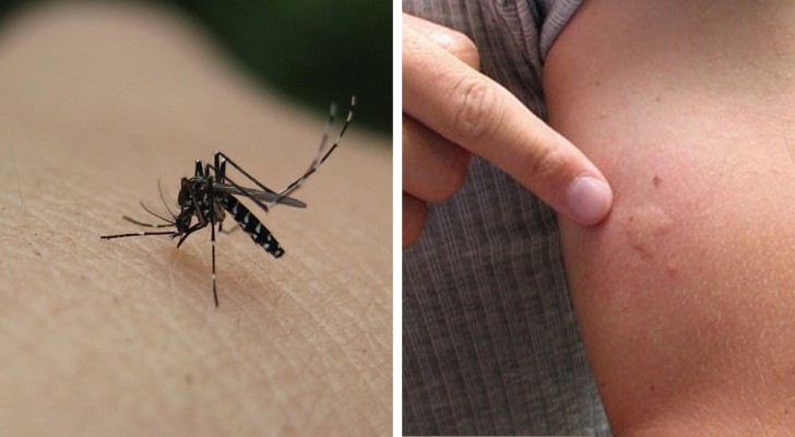 Därför blir du alltid mer myggbiten än alla andra