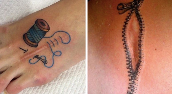 Algumas tatuagens espetaculares que transformaram cicatrizes em pequenas obras de arte