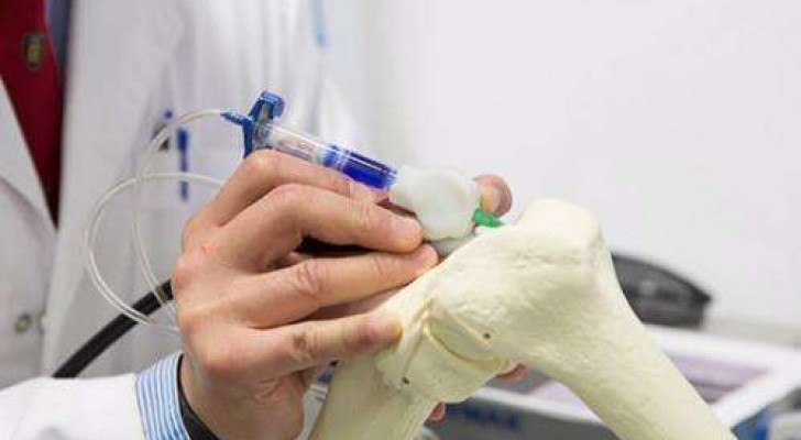 BioPen, la penna che "stampa" cellule staminali in 3D in grado di rigenerare cartilagine ed ossa
