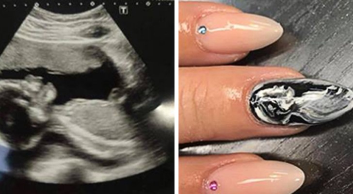 Des ongles décorés avec l'échographie de votre enfant : voici la nouvelle et étrange mode qui est en train de se développer. 