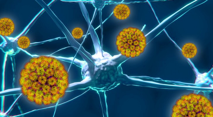 Neue Studie testet den Zusammenhang zwischen Herpes simplex und Alzheimer-Virus
