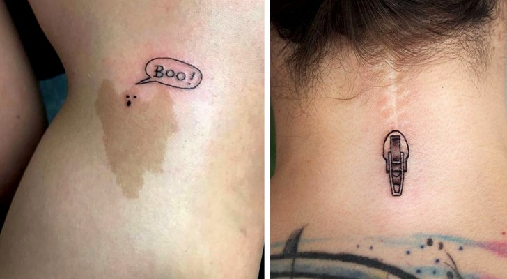 16 tatuaggi che hanno reso le cicatrici segni da guardare e riguardare