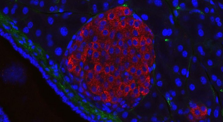 Diabete: i ricercatori hanno trasformato le cellule staminali umane nelle cellule che producono insulina