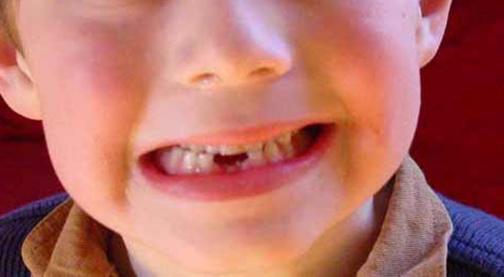 Si potrebbero ricavare cellule staminali dai denti da latte dei bambini: gli scienziati consigliano di conservarli