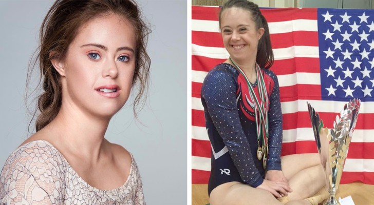 This world champion gymnast with Down syndrome challenges the canons of beauty and becomes a model