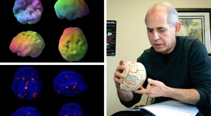 Un neuroscienziato ha trovato il modo di mantenere giovane il suo cervello, ed ora possiamo imitarlo tutti