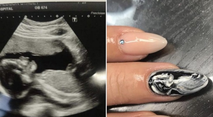 Aujourd'hui, les futures mamans utilisent des échographies pour créer des ongles inimitables