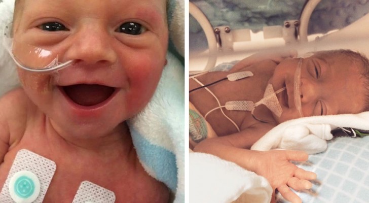 10 bilder på för tidigt födda barn som ler för att de är lyckliga över att leva