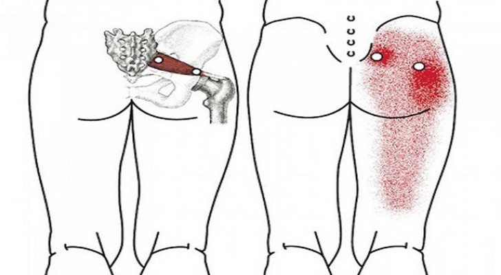 10 einfache Dehnungsübungen zur Beseitigung von Rücken-, Hüft- und Ischiasnervenschmerzen