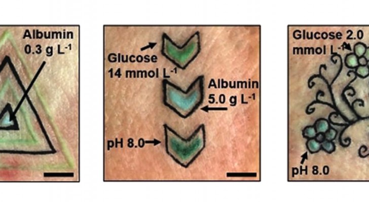 Hier sind die Tattoos, die ihre Farbe ändern, je nach den Werten von Glukose, Albumin oder pH-Wert des Blutes 