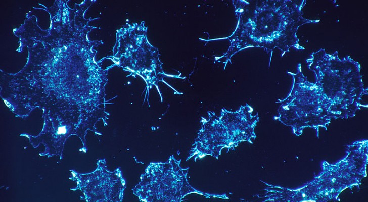 Milano: scoperta una proteina che può prevenire la formazione delle metastasi tumorali