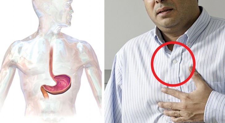 Gastroesophageal reflux (GERD) and everything you need to know to keep it under control