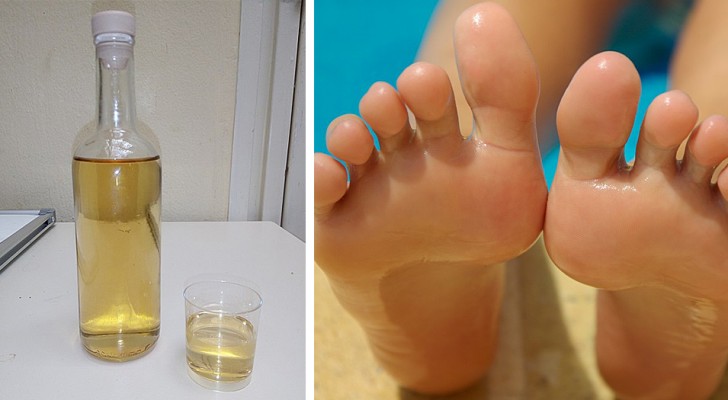 Vinegar is a precious ally for the well-being of our feet and here are the best ways to use it