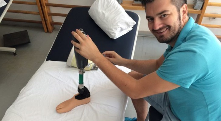 Dankzij deze bionische prothesen hebben patiënten die al lang zijn geamputeerd opnieuw hun benen gevoeld