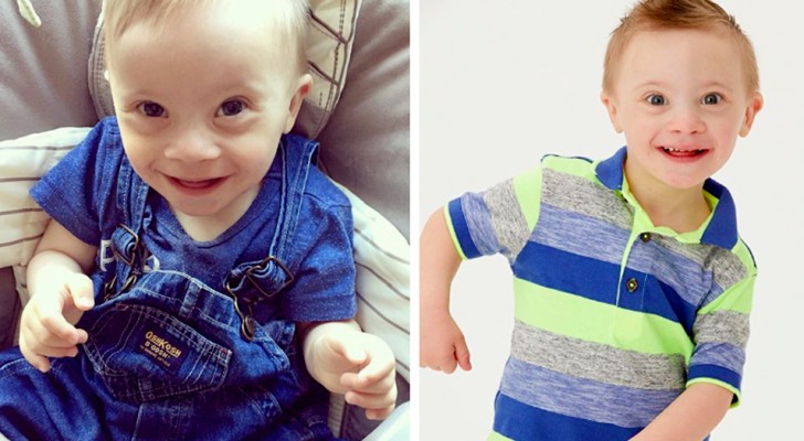 The story of Riley, a child with Down syndrome who is now a model thanks to his smile