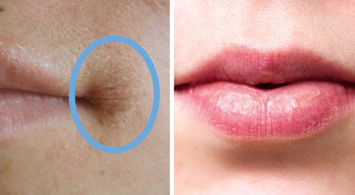 6 façons dont vos lèvres peuvent vous dire quelque chose sur votre état de santé
