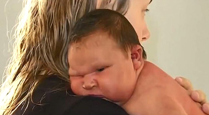 Nicknamed "a small sumo wrestler" this newborn baby weighed in at almost 12 lb (6 kg)