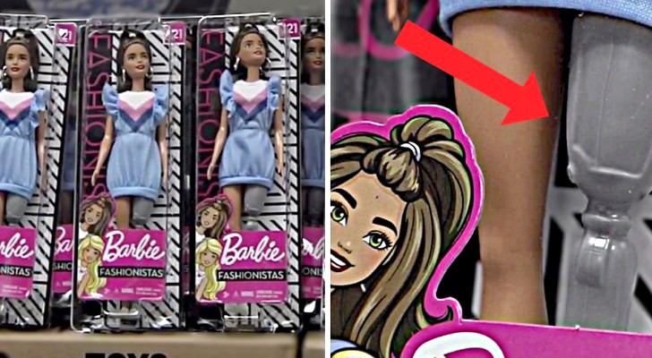 La Mattel ha donato 400 Barbie con protesi alle gambe per i piccoli pazienti di un ospedale ortopedico