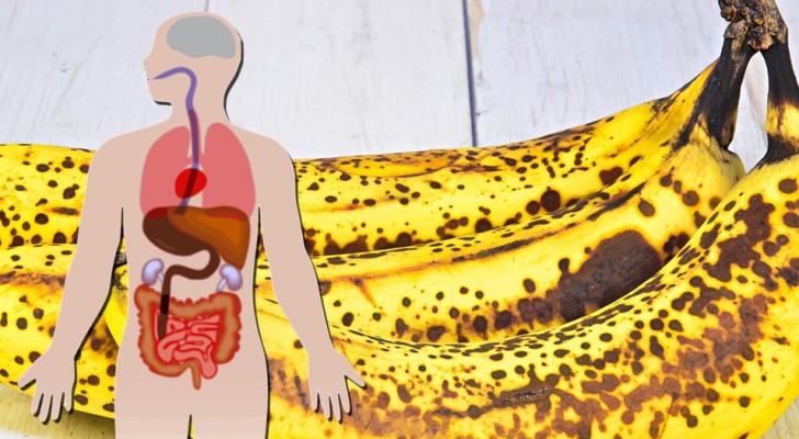 Även om den har bruna fläckar kan en banan vara mycket bra för hälsan