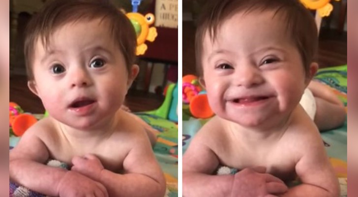 Adoptivmamman till den här lilla flickan med Downs syndrom har fotat sin dotters första leende