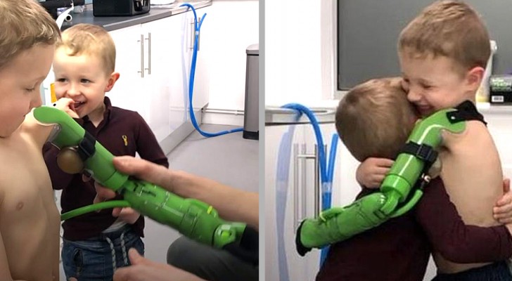 Dank eines speziellen bionischen Arms konnte dieser Junge seinen kleinen Bruder zum ersten Mal umarmen