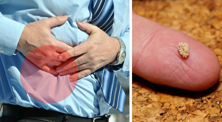 8 signs that can indicate the presence of kidney stones