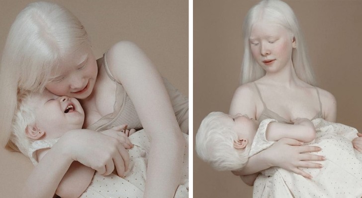 Tussen deze twee albino-zussen zit 12 jaar verschil: hun uiterlijk is uniek en fascinerend