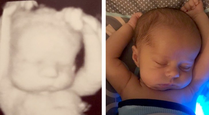 Mette a confronto la posizione in cui dorme il suo bimbo di 3 settimane con l'ecografia: è esattamente la stessa