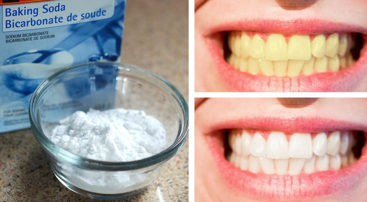 Algunos remedios caseros que pueden ayudar a blanquear los dientes de manera natural