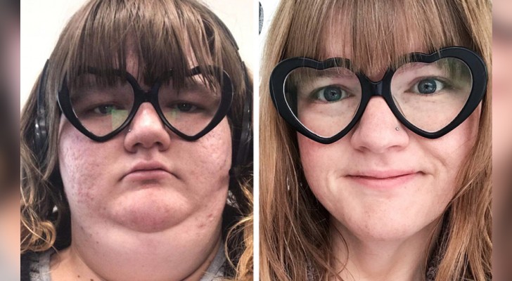 15 people who challenged themselves to lose weight and have lost so much that they are almost unrecognizable