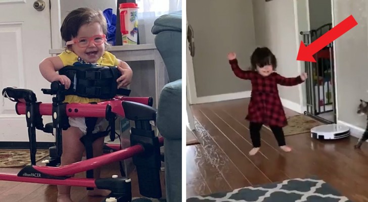 After 4 surgeries, a child with cerebral palsy makes her first steps in spite of all odds against her