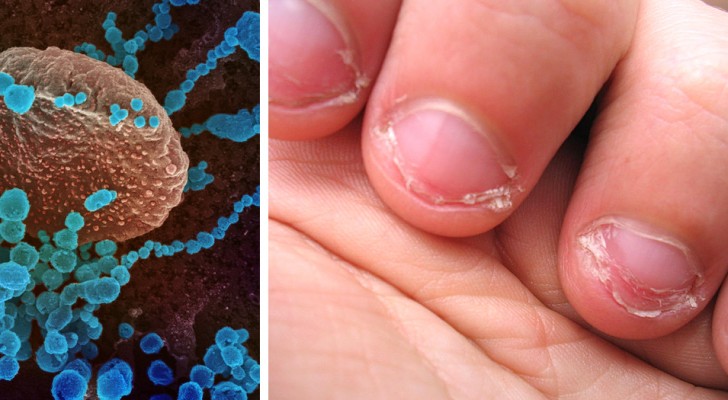 Biting your nails can increase your risk of getting Coronavirus: experts warn