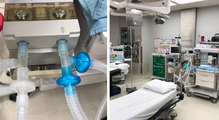 Trasforma un ventilatore polmonare in una macchina in grado di far respirare 9 persone: l'intuizione di un medico