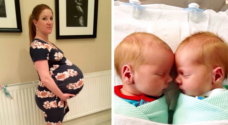 En kvinna med en enorm gravidmage föder två av de "tyngsta" tvillingarna som någonsin fötts i Skottland
