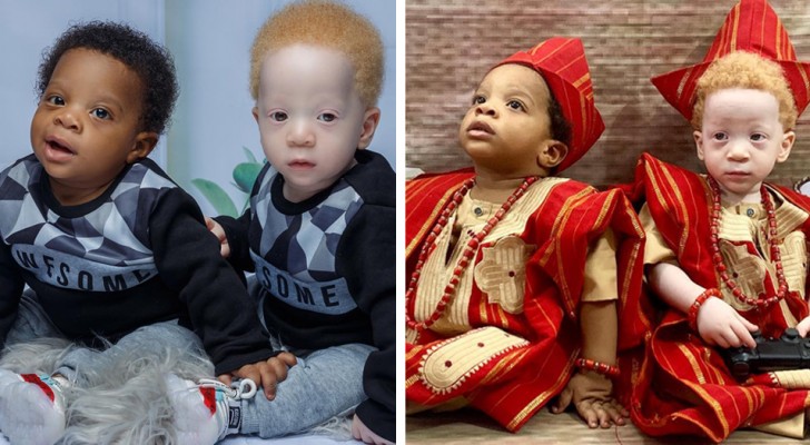 Een Nigeriaanse moeder baart een “verschillende” tweeling: de één heeft een lichte huid en goudblonde haren