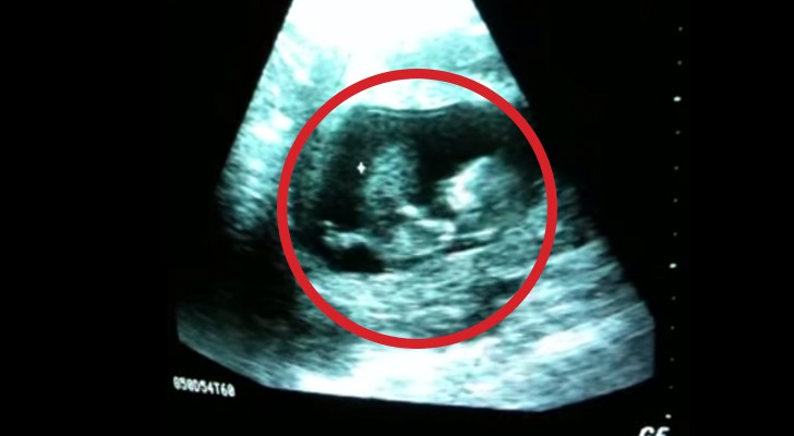 This ultrasound scan will show you how children have fun in the womb!! This is AMAZING