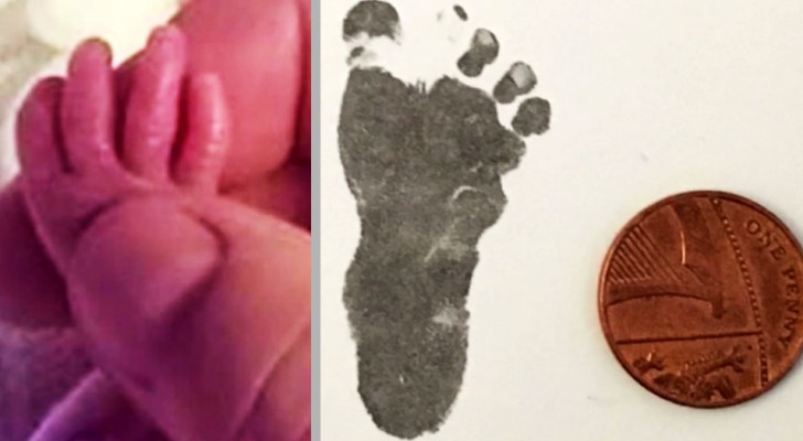 Francesca föddes för tidigt vid 24 veckor, hennes fot är knappt större än 1 penny